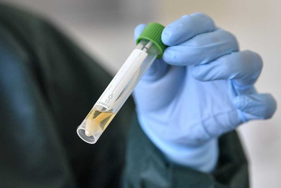 Антимонопольщики Прикамья проверяют рекламу теста на коронавирус 